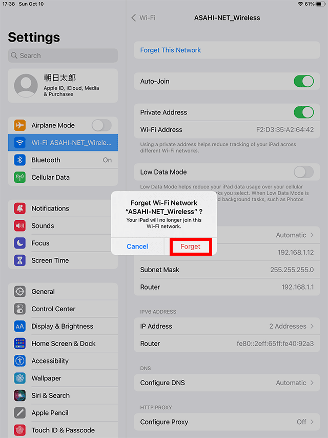 Tap Forget and the selected settings will be deleted
